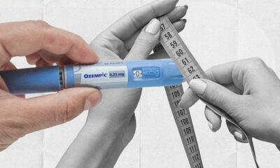  10 سال پیری زودرس با آمپول های های لاغری بدون ورزش های مقاومتی