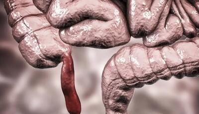  پژوهشگران از افزایش شیوع سرطانی نادر در جوانان خبر می‌دهند