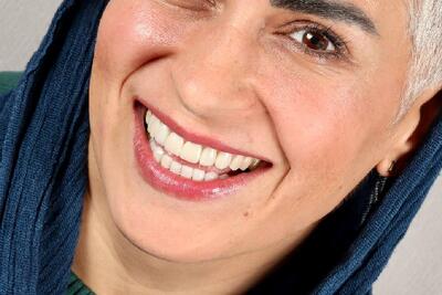  قبل از انجام کامپوزیت حتما این بلاگ را بخوانید!