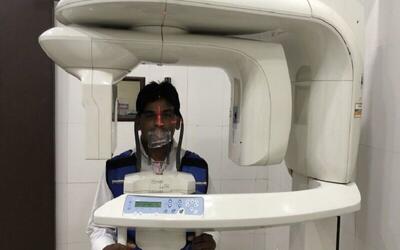  نخستین جراحی جایگزینی مهره گردن با ایمپلنت در جنوب سیستان و بلوچستان انجام شد