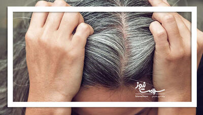 طب سنتی و علت سفیدی موها