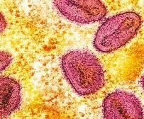 شناسایی سویه جدید «آبله میمونی» در انگلیس