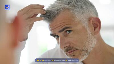 علت سفیدی مو از نظر طب سنتی چیست؟