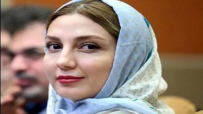  نگاه روز | تغییر چهره حدیث میرامینی بعد از جوکر 📸