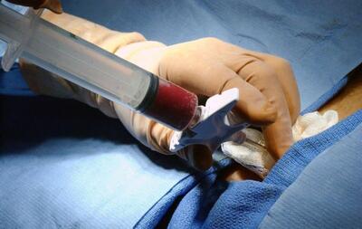 انجام پیوند مغز استخوان در ۲۰ مرکز/برای توسعه ژن درمانی برنامه‌ریزی کنیم