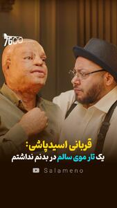 قربانی اسیدپاشی : یک تار موی سالم در بدنم نداشتم + فیلم - سلام نو