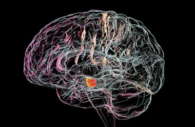 یک آزمایش درمانی در چین، امیدی تازه به بیماران پارکینسون در سراسر جهان بخشیده است