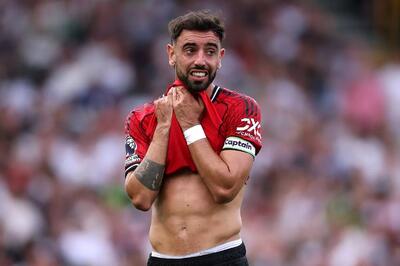 پل پارکر: برونو فرناندز مثل بچه‌ای یک ساله است؛ گل‌ها و پاس گل‌ها باعث می‌شوند غفلت‌هایش فراموش شود