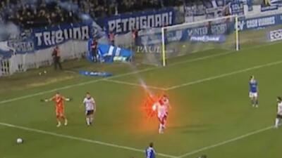 فشفشه یک فوتبالیست را سوزاند!