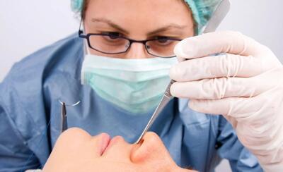  پیزوسرجری بینی چیست و چگونه انجام می شود ؟