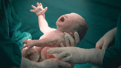  زایمان طبیعی و بدون درد چه محاسنی دارد؟