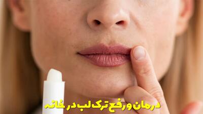  درمان و رفع ترک لب در خانه | بهترین پماد برای ترک لب و خشکی آن