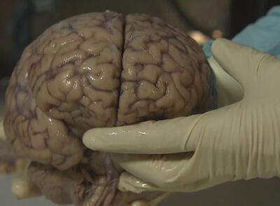 چرا انسان فقط  ۱۰ درصد توان مغز خود را به کار می‌گیرد؟