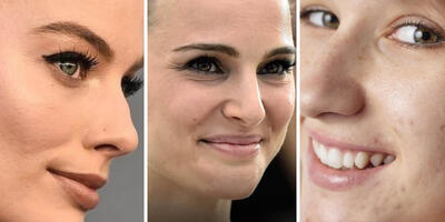 پوست طبیعی و بینی قوزدار ترند شدند! زیبایی دور از دسترس دیگر مد نیست - چی بپوشم