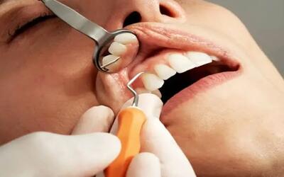 شناسایی دندانپزشکان فاقد مجوز با گزارش مردمی