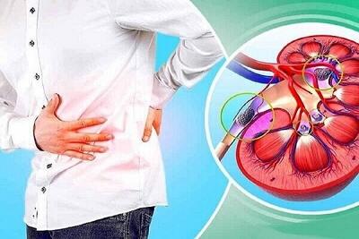 خطر ابتلا به نارسایی کلیه در پی مصرف داروهای گیاهی