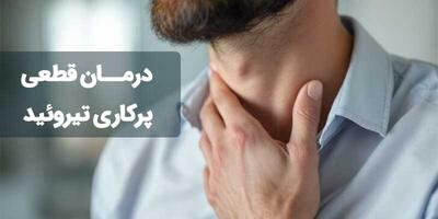  آیا پرکاری تیروئید درمان قطعی دارد؟