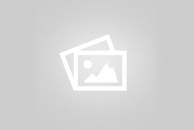  مزایای ایمپلنت دندان و معرفی کاشت ایمپلنت به روش پانچ: تجربه‌ای سریع، راحت و مطمئن