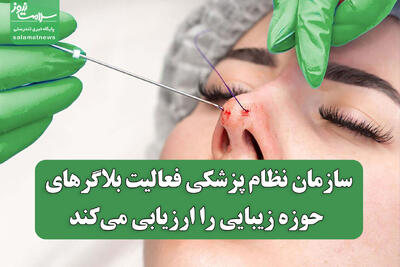 سازمان نظام پزشکی فعالیت بلاگرهای حوزه زیبایی را ارزیابی می‌کند