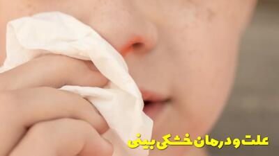  خشکی بینی نشانه چیست؟ بهترین درمان خانگی و دارویی خشکی بینی