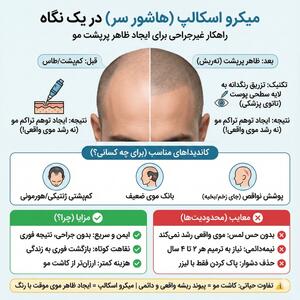  کاشت مو به روش میکرو اسکالپ چیست؟ تحلیل پزشکان شیراز را بخوانید