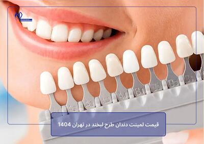  قیمت لمینت دندان طرح لبخند