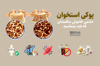  نمودار زندگی/ پوکی استخوان؛ دشمن خاموش سالمندی