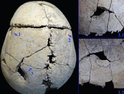 کشف گور ۶۲۰۰ ساله یک نوجوان