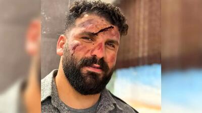 عکس میلاد کرمی بلاگر معروف به وضعتان چونه بعد از سقوط از کوه ../ اینبار وضعتان خرابه ... + فیلم