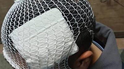 پرتاب لیوان از سوی معلم به سمت دانش‌آموز ! / کار به بیمارستان کشید