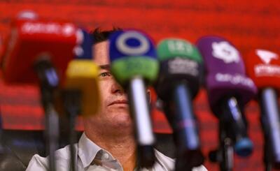 اوسمار: باید بندی در قراردادم برای سفیدشدن موهایم امضا می‌کردم!