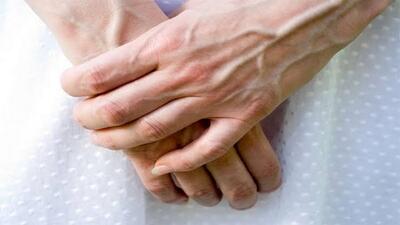  چرا رگ‌ دستم سبز است؟