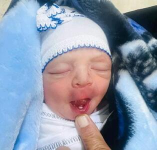 یک اتفاق نادر؛ نوزادی با دندان به دنیا آمد (+عکس)