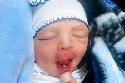 این نوزاد با چیزی غیرعادی به دنیا آمد!