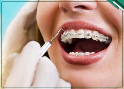 تفاوت انجام ارتودنسی در کودکان و بزرگسالان: ۵ تفاوت کلیدی و مهم