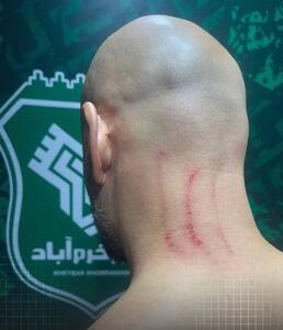 ادعای باشگاه استقلال: مربی ما را کتک زدند!+عکس