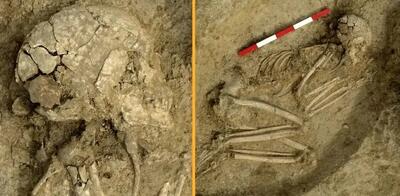 فرو رفتن دندان شیر در جمجمه یک نوجوان + عکس | اسکلت ۶ هزار سال قبل را ببینید