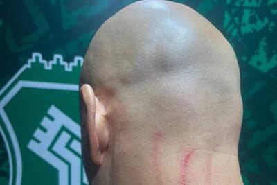 جراحت مربی دروازه‌بان‌های استقلال در پایان بازی با خیبر - پارس فوتبال