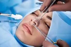  زمان مناسب برای شروع ورزش بعد از جراحی بینی