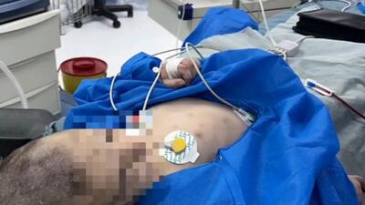 دکتر جراح راز شکنجه های دختر 3 ساله را در قم فاش کرد / بازداشت نامادری + فیلم و عکس ناراحت کننده