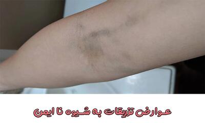  عوارض تزریق سرم؛ از علائم ساده تا خطرات جدی را بشناسید!