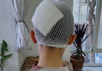 کلاس درس یا میدان خشم؟/ پرتاب لیوان سر دانش‌آموز گلستانی را شکافت - تسنیم