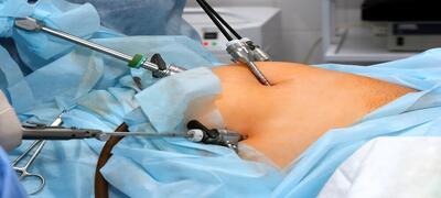  این روش درمان چاقی سلامتی شما را تهدید می‌کند