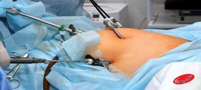  این روش درمان چاقی سلامتی شما را تهدید می‌کند - کلبه سرگرمی