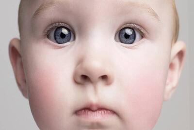 زوال عقل از کودکی می‌آید