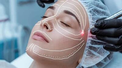  جراحی لیفت صورت یا اندولیفت؟ کدام یک سرمایه گذاری اقتصادی تری است؟