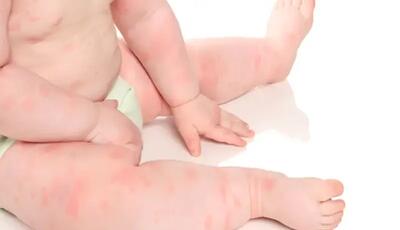 پوست کودک حرف می‌زند