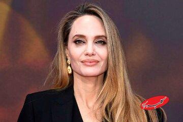 خودافشاگری شجاعانه بازیگر زن از زخم‌های بدنش - کلبه سرگرمی