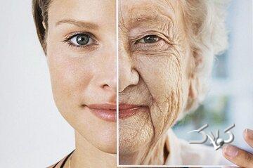موثرترین روش جوانسازی پوست/ بهترین روش برای رفع تیرگی و چین‌های عمیق/ روشی برای رفع جوش‌های پوستی - مجله اینترنتی کولاک