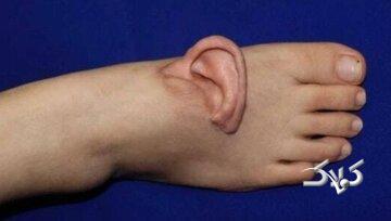 نجات لاله گوش زن چینی با پیوند موقت روی پا - مجله اینترنتی کولاک